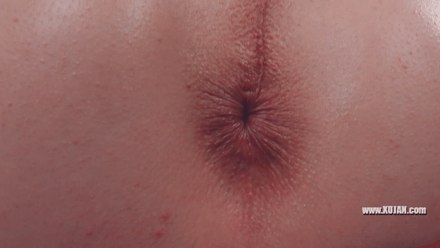 trans anal matnutyun